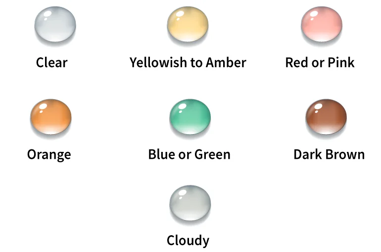 Colour of urine